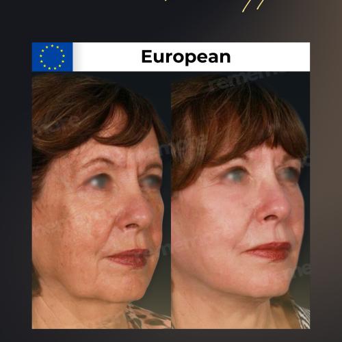 صور قبل وبعد لمرضانا 7